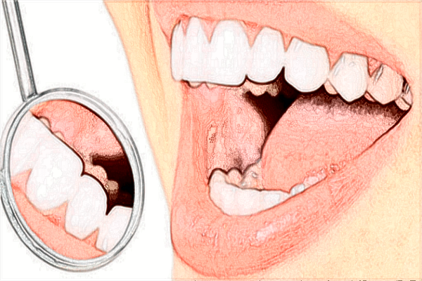 九江市中医院牙科洗牙怎么样?洗牙能让牙齿变白吗?