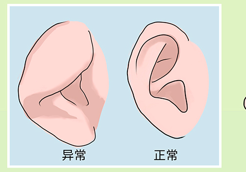 广东佛山市第二人民医院耳朵矫正技术风格怎么样?术后三个月案例曝光